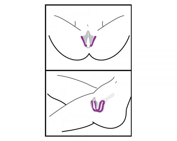 modelo separador de labios vaginales